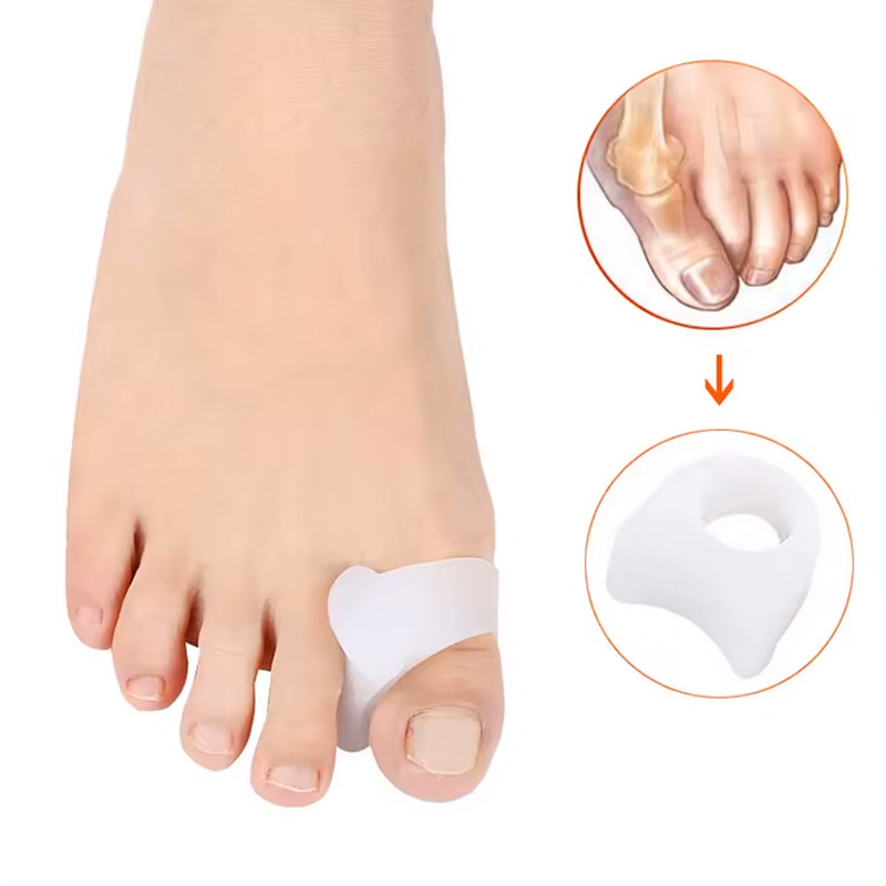 Tåring med tåspreder - 2 stk. - Adskil tæerne ved hallux valgus