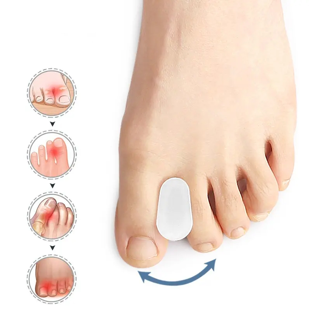 Tåspreder til hallux valgus - 2 stk. - Adskiller tæerne for at reducere smerte